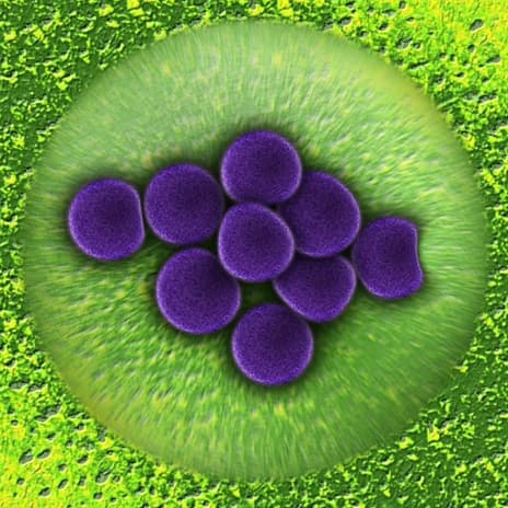 MRSA bacteria purple stain on light green background